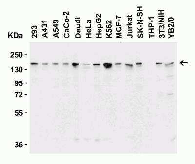 Western Blot: Lysine (K)-specific Demethylase 6B/KDM6B/JMJD3 AntibodyBSA Free [NBP2-82107]