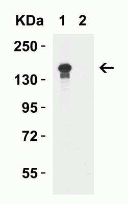 Western Blot: Lysine (K)-specific Demethylase 6B/KDM6B/JMJD3 AntibodyBSA Free [NBP2-82107]