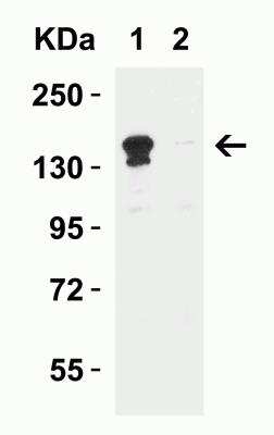 Western Blot: Lysine (K)-specific Demethylase 6B/KDM6B/JMJD3 AntibodyBSA Free [NBP2-82107]