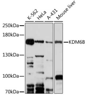 Western Blot: Lysine (K)-specific Demethylase 6B/KDM6B/JMJD3 AntibodyAzide and BSA Free [NBP2-92981]