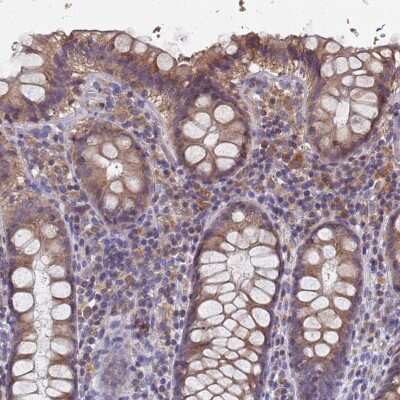 Immunohistochemistry-Paraffin: Lysine-rich coiled-coil 1 Antibody [NBP1-92092]