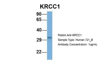 Western Blot: Lysine-rich coiled-coil 1 Antibody [NBP1-79654]