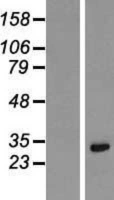 Western Blot: Lysine-rich coiled-coil 1 Overexpression Lysate [NBL1-12377]