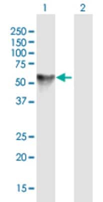 Western Blot: Lysosomal Pro-X Carboxypeptidase/PRCP Antibody [H00005547-B01P]