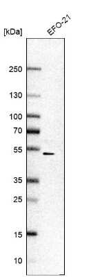 Western Blot: Lysosomal Pro-X Carboxypeptidase/PRCP Antibody [NBP1-81644]