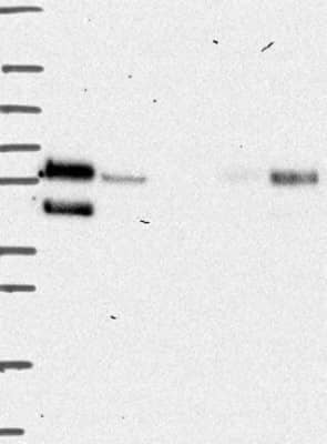 Western Blot: Lysosomal Pro-X Carboxypeptidase/PRCP Antibody [NBP3-17883]