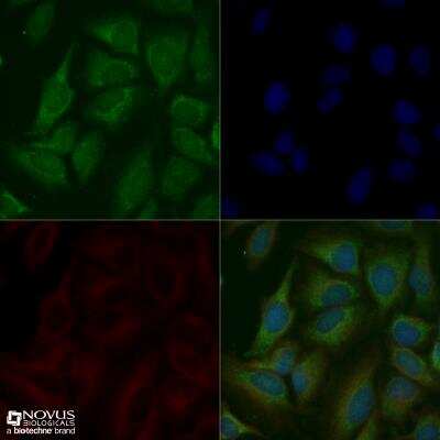 Immunocytochemistry/ Immunofluorescence: Lysozyme Antibody - BSA Free [NBP2-61118]