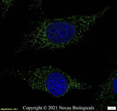 Immunocytochemistry/ Immunofluorescence: Lysozyme Antibody - BSA Free [NBP2-61118]