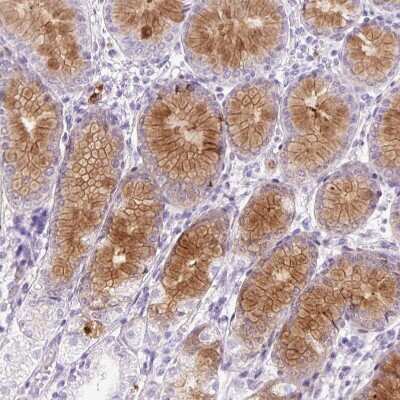 Immunohistochemistry-Paraffin: Lysozyme Antibody [NBP2-33518]