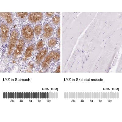 Immunohistochemistry-Paraffin: Lysozyme Antibody [NBP2-33518]