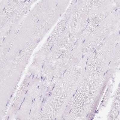 Immunohistochemistry-Paraffin: Lysozyme Antibody [NBP2-33518]