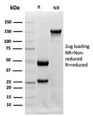 Western Blot: Lysozyme Antibody (LYZ/3942)Azide and BSA Free [NBP3-14114]