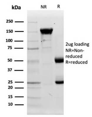 Protein Array: Lysozyme Antibody (LYZ/3944) - Azide and BSA Free [NBP3-14115]