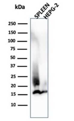 Western Blot: Lysozyme Antibody (LYZ/3944) [NBP3-13962]