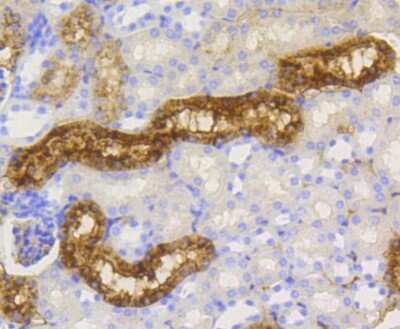 Immunohistochemistry-Paraffin: Lysozyme Antibody (ST50-02) [NBP2-67507]