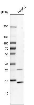 Western Blot: Lysozyme Antibody [NBP2-33518]