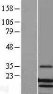 Western Blot: Lysozyme Overexpression Lysate [NBL1-12771]