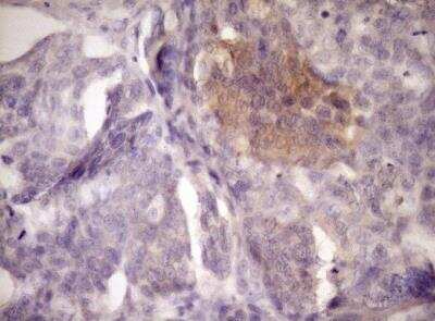 Immunohistochemistry-Paraffin: Lysyl Oxidase Homolog 2/LOXL2 Antibody (OTI8B2) [NBP2-45669]