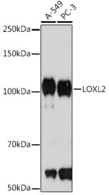 Western Blot: Lysyl Oxidase Homolog 2/LOXL2 Antibody (9F0W6) [NBP3-16466]