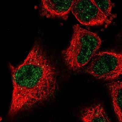 Immunocytochemistry/ Immunofluorescence: Lysyl Oxidase Homolog 2/LOXL2 Antibody [NBP2-56739]