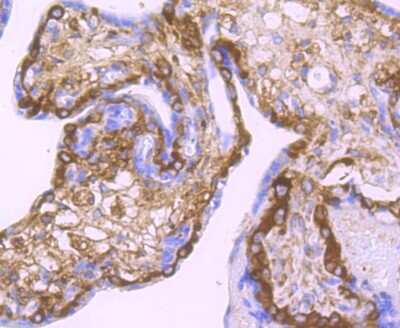 Immunohistochemistry-Paraffin: Lysyl Oxidase Homolog 2/LOXL2 Antibody (JU32-53) [NBP2-75559]