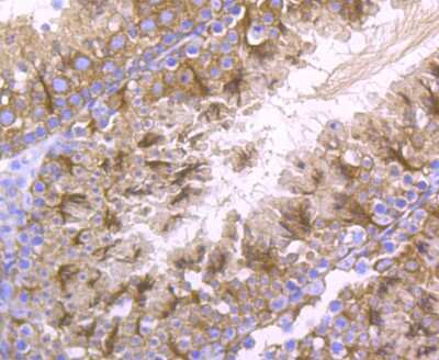 Immunohistochemistry-Paraffin: Lysyl Oxidase Homolog 2/LOXL2 Antibody (JU32-53) [NBP2-75559]