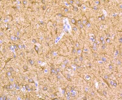 Immunohistochemistry-Paraffin: Lysyl Oxidase Homolog 2/LOXL2 Antibody (JU32-53) [NBP2-75559]