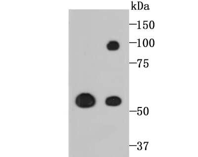 Western Blot: Lysyl Oxidase Homolog 2/LOXL2 Antibody (JU32-53) [NBP2-75559]