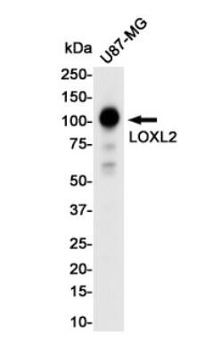 Western Blot: Lysyl Oxidase Homolog 2/LOXL2 Antibody (S09-7J5) [NBP3-19679]