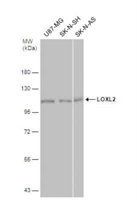 Western Blot: Lysyl Oxidase Homolog 2/LOXL2 Antibody [NBP1-32954]