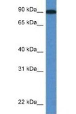 Western Blot: Lysyl Oxidase Homolog 2/LOXL2 Antibody [NBP1-74065]