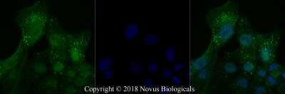 Immunocytochemistry/ Immunofluorescence: Lysyl Oxidase Homolog 3/LOXL3 Antibody - BSA Free [NBP2-75964]
