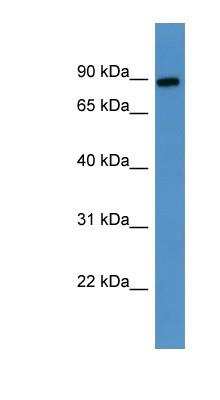 Western Blot: Lysyl Oxidase Homolog 3/LOXL3 Antibody [NBP1-79803]