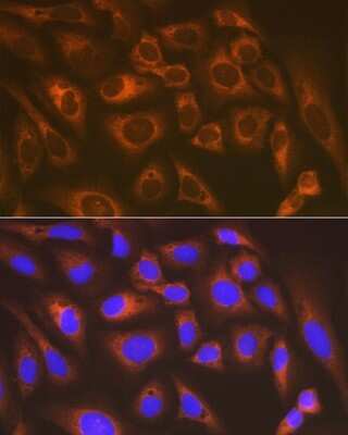 Immunocytochemistry/ Immunofluorescence: Lysyl tRNA synthetase Antibody (2V2B6) [NBP3-16670]