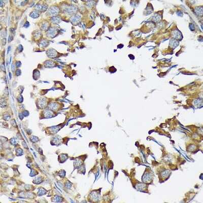 Immunohistochemistry-Paraffin: Lysyl tRNA synthetase Antibody (2V2B6) [NBP3-16670]