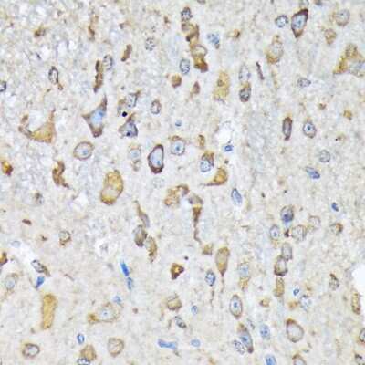Immunohistochemistry-Paraffin: Lysyl tRNA synthetase Antibody (2V2B6) [NBP3-16670]