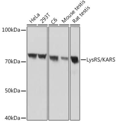 Western Blot: Lysyl tRNA synthetase Antibody (2V2B6) [NBP3-16670]