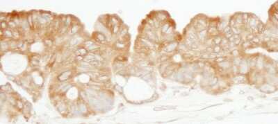 Immunohistochemistry: Lysyl tRNA synthetase Antibody [NB100-1719]