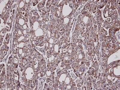 Immunohistochemistry-Paraffin: Lysyl tRNA synthetase Antibody [NBP1-32063]