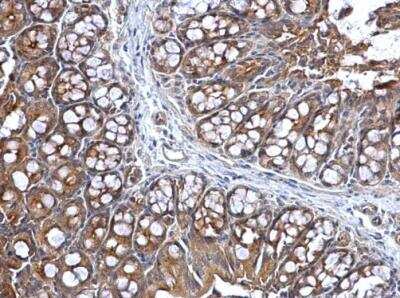 Immunohistochemistry-Paraffin: Lysyl tRNA synthetase Antibody [NBP1-32063]
