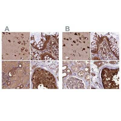 Immunohistochemistry-Paraffin: Lysyl tRNA synthetase Antibody [NBP1-87705]