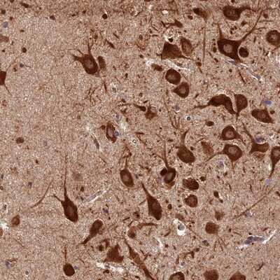 Immunohistochemistry-Paraffin: Lysyl tRNA synthetase Antibody [NBP1-87706]