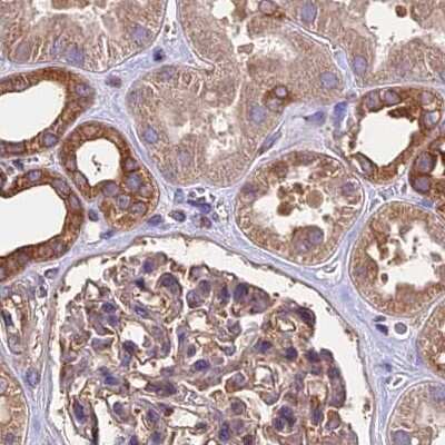 Immunohistochemistry-Paraffin: Lysyl tRNA synthetase Antibody [NBP1-87706]