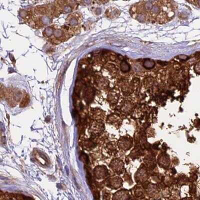 Immunohistochemistry-Paraffin: Lysyl tRNA synthetase Antibody [NBP1-87706]