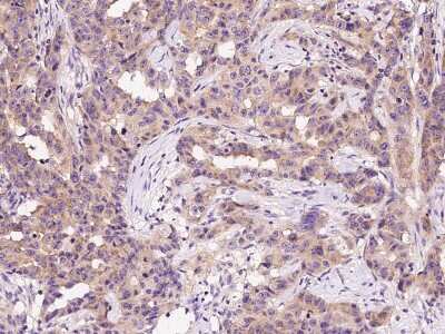 Immunohistochemistry-Paraffin: Lysyl tRNA synthetase Antibody [NBP2-99362]