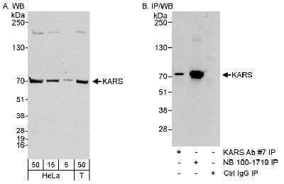 Western Blot: Lysyl tRNA synthetase Antibody [NB100-1719]