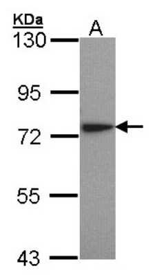 Western Blot: Lysyl tRNA synthetase Antibody [NBP1-32063]