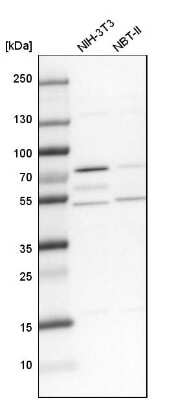 Western Blot: Lysyl tRNA synthetase Antibody [NBP1-87706]