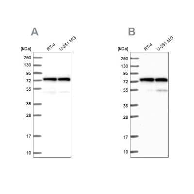 Western Blot: Lysyl tRNA synthetase Antibody [NBP1-87706]