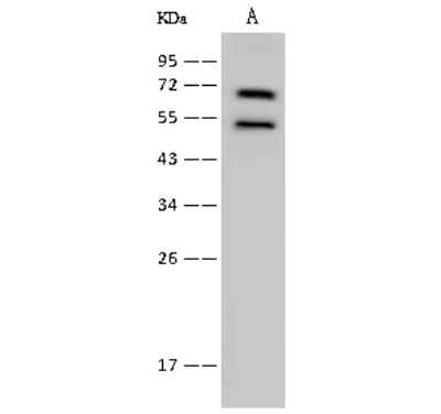 Western Blot: Lysyl tRNA synthetase Antibody [NBP2-99362]